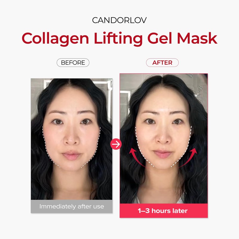 CANDORLOV Korean Collagen Duo: Overnight Collagen Lifting Hydrogel Mask (5pcs)