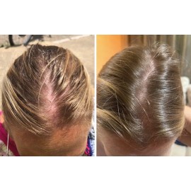 Naturalmayer Gotero Mamajuana Anti Caída Y Crecimiento /Anti-Loss and Growth Hair Dropper.