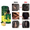 Ginger Hair Growth Germinal Oil, Regrow 7 Days Ginger Germinal