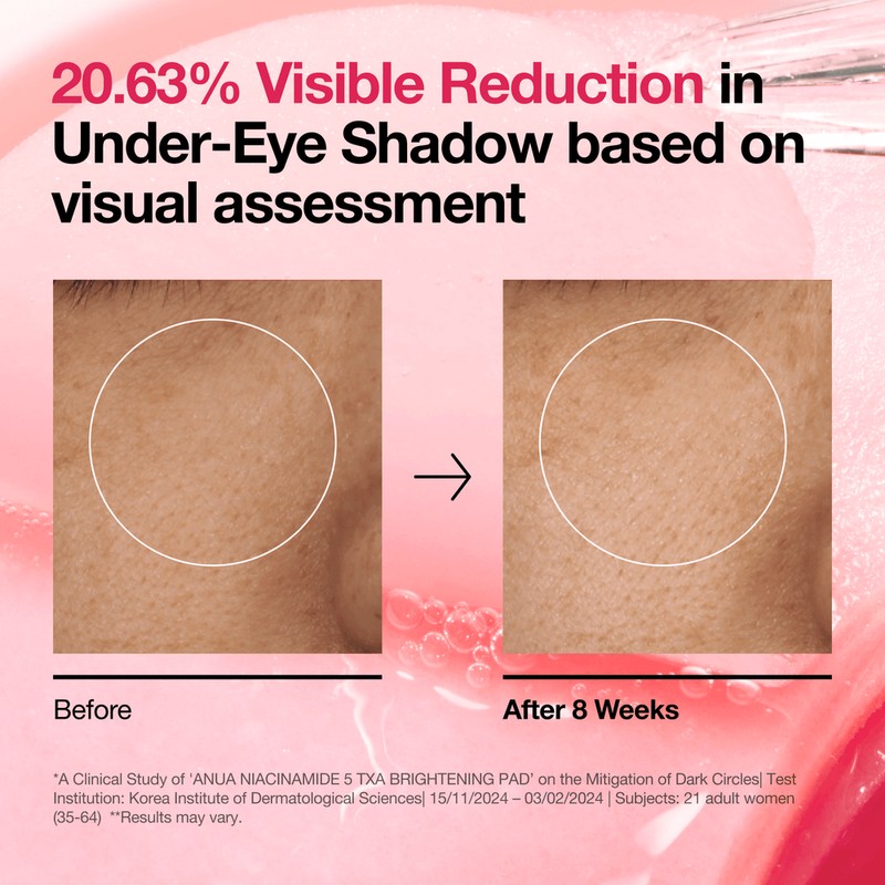 Anua [Anua]Niacinamide 5 TXA Brightening Pad (60ea)