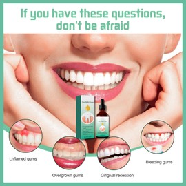 Gum Regrowth Drops,30ml Gum Repair for Receding Gums,Natural Gum Restore Liquid Drops for Oral Care,Gum Regrowth for Receding Gums,Fresh Breath Gum Repair Treatment for Gum Health,Gum Disease Gel