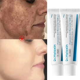 Crema Facial Despigmentante Y Anti Manchas Pack X2 Pa
