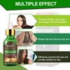 Anti-Hair Loss, Hair Growth Serum, Hair Loss and Hair Treatment,