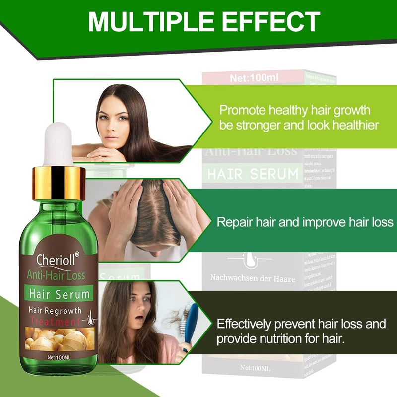 Anti-Hair Loss, Hair Growth Serum, Hair Loss and Hair Treatment,