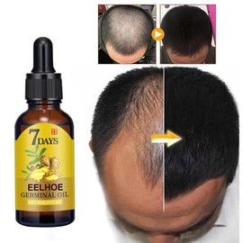 EELHOE 7 Day Fast Hair Growth Oil Ginger Growth Hair Treatment Anti Hair Loss Men Women Scalp Treatment Serum Products - Color: 40ml