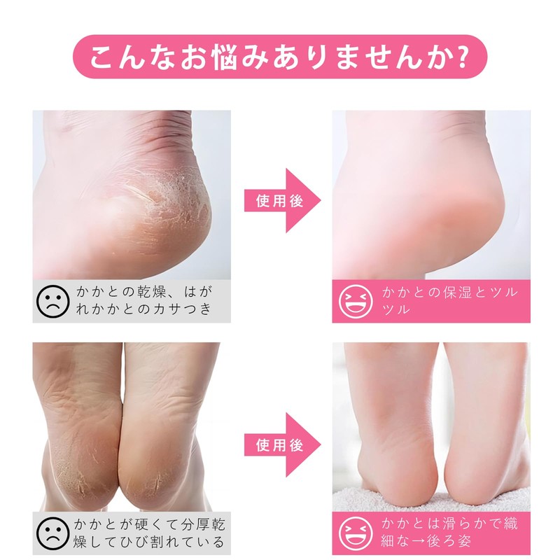 かかとケア靴下 かかと保湿ソックス【4足組 】ヒールケアソックス 質ケア ひび割れ対策 ツルルツル かかとつるつるめ 保湿保護 就寝時間 かかと用集中保湿ソックス