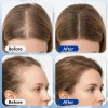 Suero Capilar Para Crecimiento Cabello 3% Romero 1.01 Oz