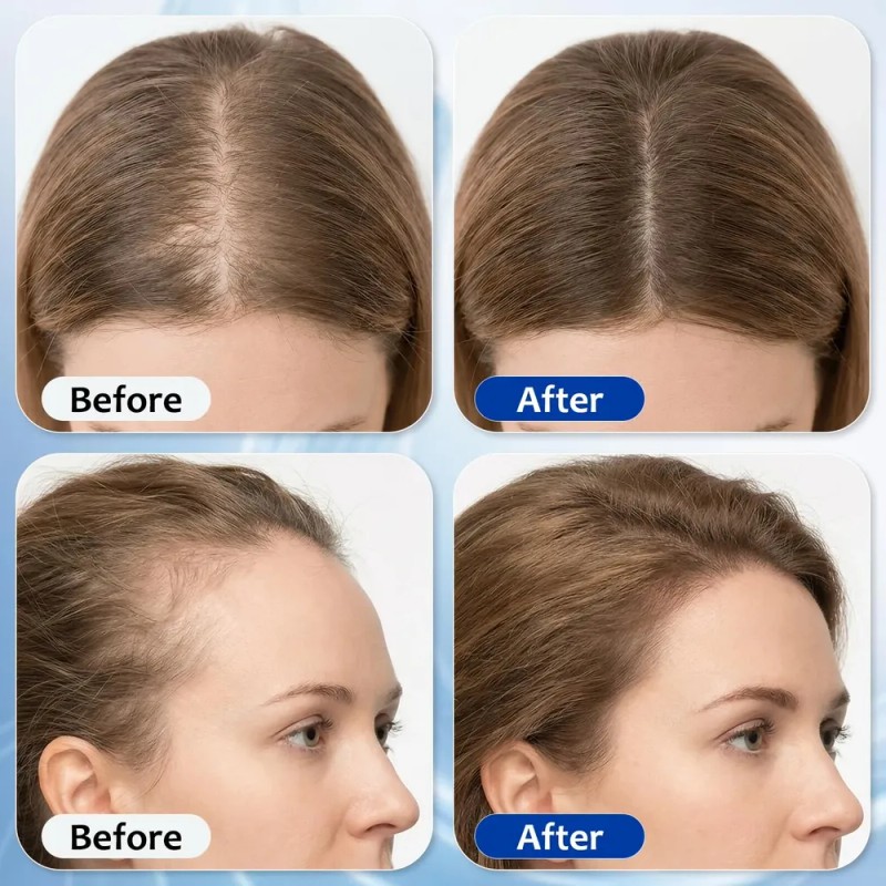 Suero Capilar Para Crecimiento Cabello 3% Romero 1.01 Oz