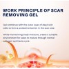 Gel De Silicona Para Cicatrices, Gel Avanzado De Eliminación