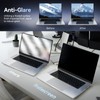 Magnetic Privacy Screen Protector Compatible with MacBook Pro 14 Inch