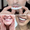 2PCS False Teeth - Unisex Snap-On Veneer - False Tooth