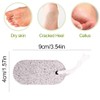 Pumice Stone Foot Care, Pack of 2 Pumice Stone Callus