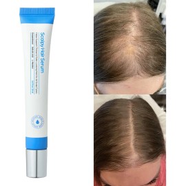 Sérum Para Crecimiento De Cabello Y Cuero Cabelludo 20ml