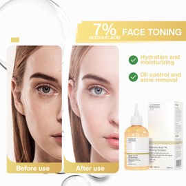 Glycolic Acid Toner: 240ml Glycolic Acid for Blemishes Poren Verkleinern Hydrates Reduces Skin Blemishes for Combination Oily Skin