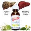 ALKA VITA Higado Limpio Saludable Remedio Herbal Gotas Alcachofa Cola