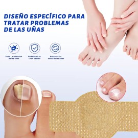 Parches Para Uñas Fúngicos 30pcs/caja De Parches Para
