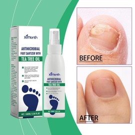 Foot Sanitizer Spray with TeaTree Oi & Aloe Vera - Prevents Foot Odors & Shoe Odors - Specification: 2 bottles