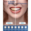 MySmile MySmile Teeth Whitening Kit with Whitening Light - 4Pcs