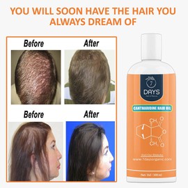 Generic 7 DAY Cantharidine Oil for hair | Control Hair Fall | Reduce Dandruff | Hair Growth Oil | | Made in India | Multi-Purpose Hair Growth Oil/Serum For Complete Hair Treatment with Argan, Bhringraj, Hibiscus, Sesame,Amla,Sweet Almond, Olive and more. (100 ml), 3.38 Fl Oz