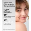 AZEANE ACIDO AZELAICO 15% CREMA 30ML, (ACM)