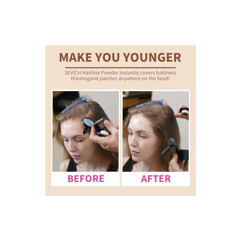 (Black) - Instantly Hair Shadow - Sevich Hair Line Powder,