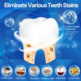 Teeth Whitening Strips, Tooth Whitening Kits, at Home Teeth whitening Strips Teeth Whitening Strips 14 Sensitive Strips + 4 Instant Strong Whitening Strips for Teeth