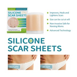 West&Month Self-adhesive silicone scar patch: West&Month Self-adhesive Silicone Scar Patches: Perfect after one application. Repairing cellulite and growth lines, smoothing skin care beauty patches - Color: one