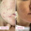 Sand & Sky Brilliant Skin Purifying Pink Clay Mask
