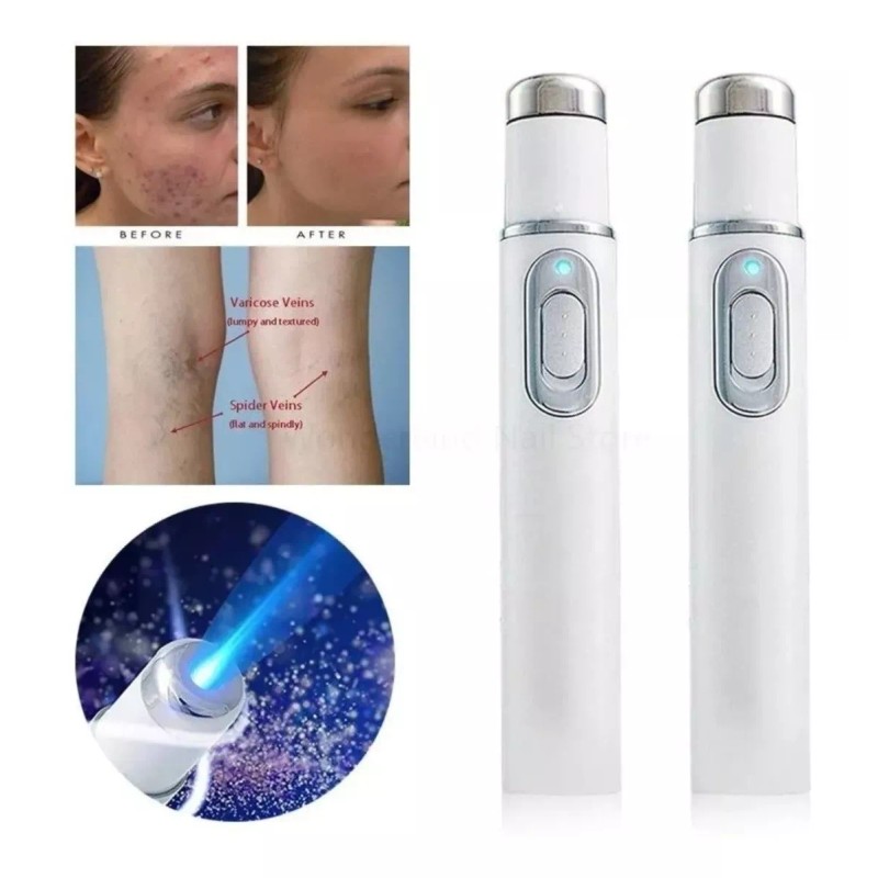 YKJ Pluma Anti-acné Manchas Cicatrices Tratamiento Facial