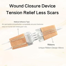 MEMNUN Wound Fastener Device, Emergency Wound Repair, No Surgical Suture Required, Family Backup, Outdoor Sports, Camping Essential (Pack of 5)