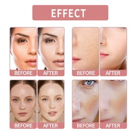 Whitening Anti-Wrinkle Cream,Firming Anti Aging Face Cream,Pigmentation Removal Cream,Dark Spot Remover for Face,Freckle Remove Anti Wrinkle F-ace Crea-m,Whitening Fa-ce Cre-am for All Skin Type