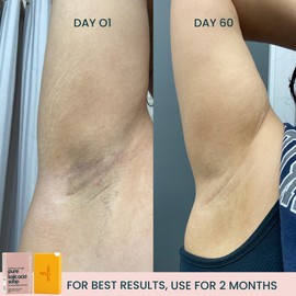 Pure Kojic Acid Soap Bar for Hyperpigmentation and Dark Spots - Dark Spot Remover for Face and Body - For Women with Medium to Dark Skin - Original, Natural & Fragrance Free - 5.3 oz by Marie France