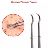 Margalla Int® Sharp Tweezers Blackhead Pimple Popper Remover Professional Skin
