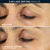 Roc Retinol Correxion Anti Aging Eye Cream Treatment Packaging May