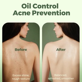 SAISZE Tea Tree Soap, Handmade Soap Bar for Face and Body, Cold Process, Soothing Hydrating Body Wash for Clear Healthy Skin 8 Ounce