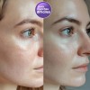 Crema Despigmentante Para Manchas, Melasma, Acné Y Paño 50g