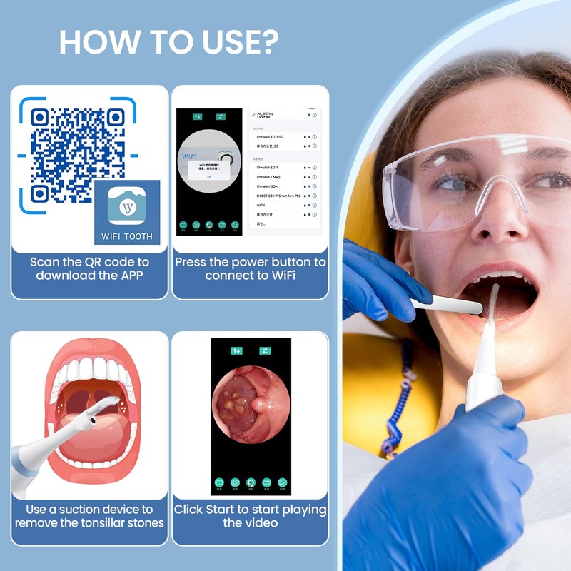 Tonsil Stone Remover with Camera,Electronic Tonsil Stone Removal Kit with