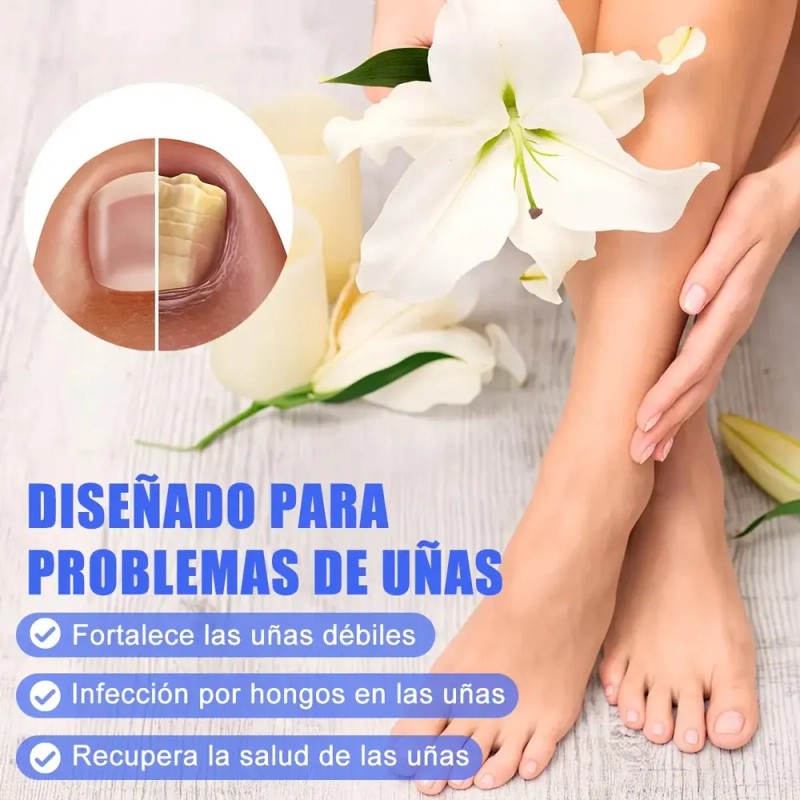42pz Parches Antimicóticos For El Tratamiento De Uñas 2026