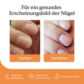 Health Routine Nail Growth Serum Set of 5 - Nail Oil for Healthy Fingernails & Toenails - Fast Growth - Natural Nail Hardener with Jojoba Oil & Biotin