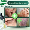 ABERA Alan Silver Nano Serum - Treat psoriasis, ringworm, restore