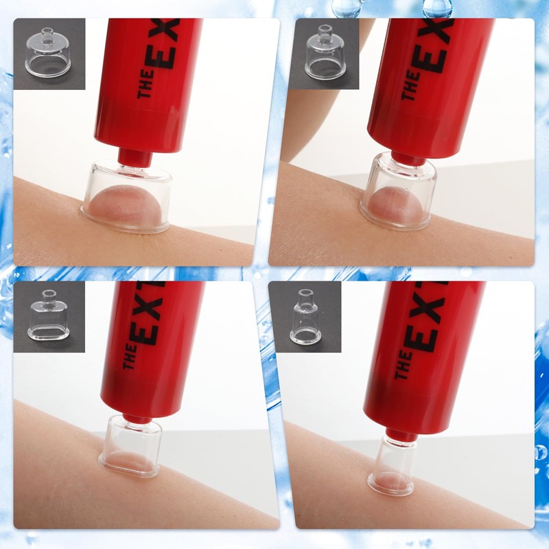 Gvhntk Snake Bite Kit Sting Kit Venom Extractor Suction Pump