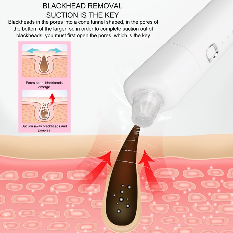 Blackhead Remover Pore Vacuum 3 Suction Power Deep Cleansing Electric