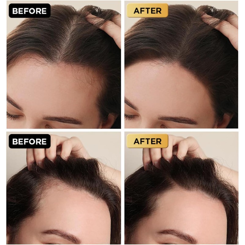 Suero para Crecimiento Capilar Fórmula Natural 30ml