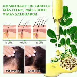 Aceite de Romero：Aceite de Romero para El Cabello-Aceite para Cabello Masajeador del Cuero Cabelludo-60ML Rosemary Oil Hair Growth Esencial Romero - 1