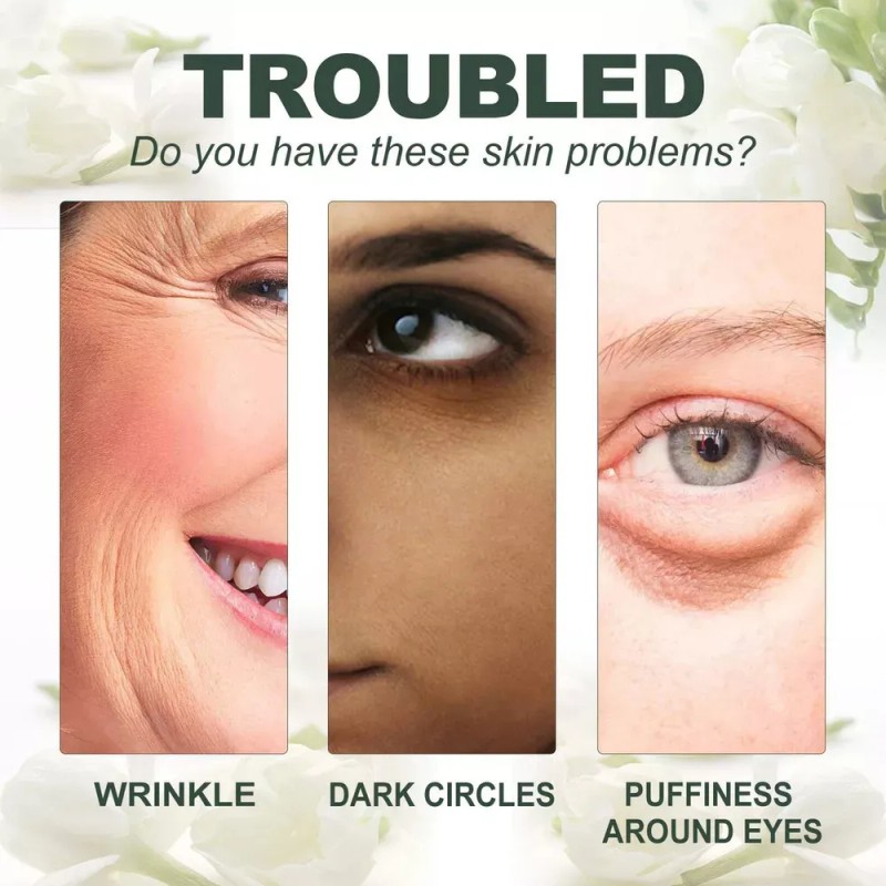 Crema De Ojos Para Eliminar Ojeras Con Jazmín, Ojeras,