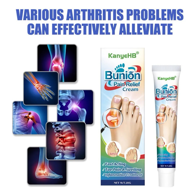 A Pomada Para El Dolor Del Juanete B Pomada Para