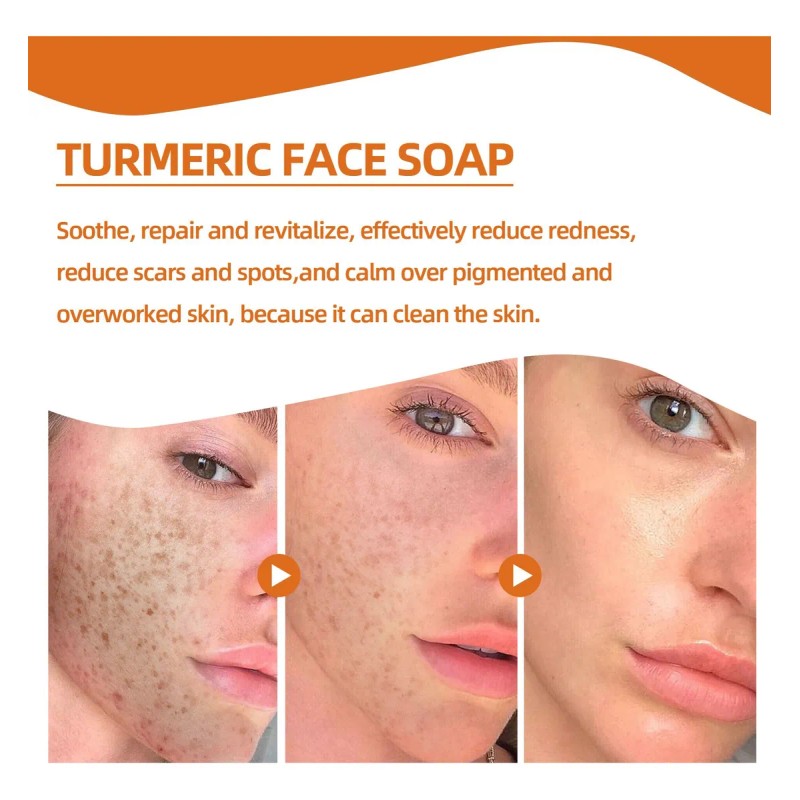 Jabón Electrónico, Limpiador De Cúrcuma, Exfoliante Natural,