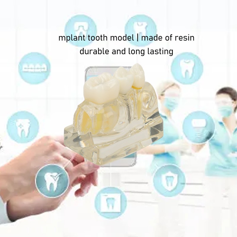 Teeth Implant Model Transparent Dental Teaching Research Demonstration Teeth Model