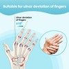 DrFinger Finger Ulnar Deviation Splint Brace, Finger Joint Deviation Orthopedic