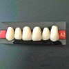 Unbranded 96PCS/Card Dental Tooth Veneer Anterior Resin Thin Teeth Veneers